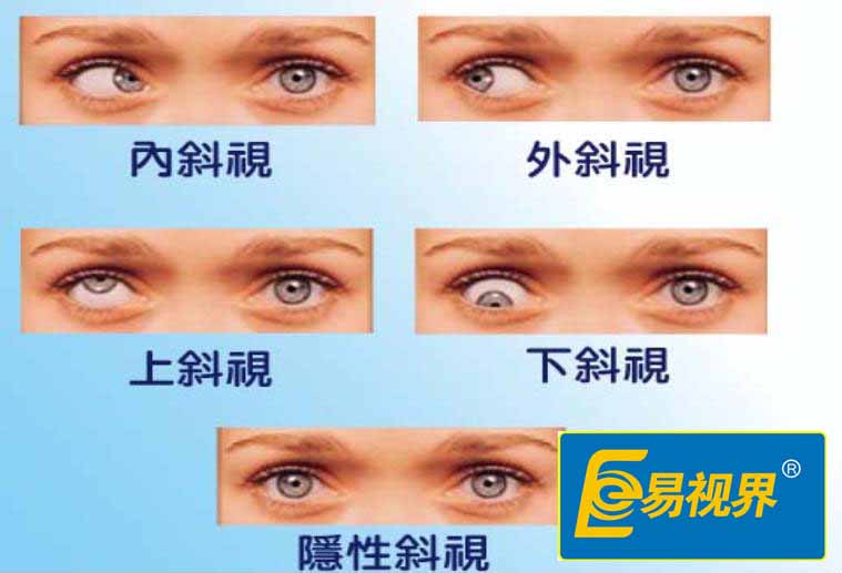 易视界护眼专家:浅谈日常视力保护