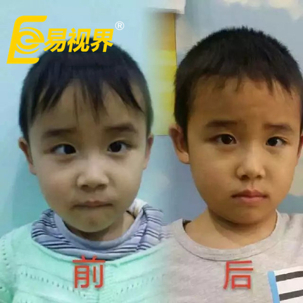 易视界为孩子带来光明与希望