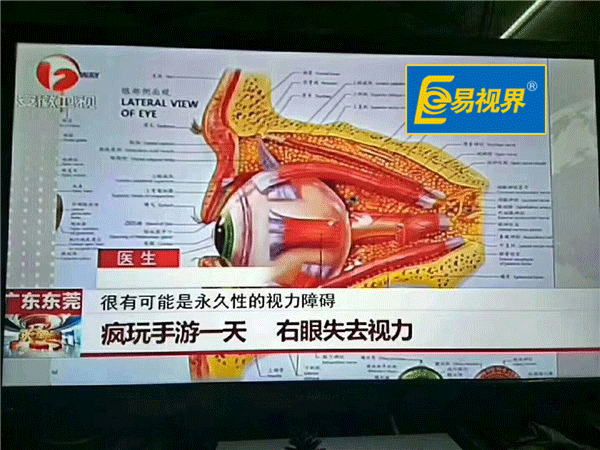 疯玩手机一天右眼失去视力_易视界
