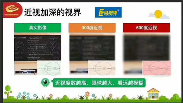 高度近视有哪些危害【易视界】
