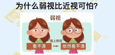 为什么弱视比近视可怕?