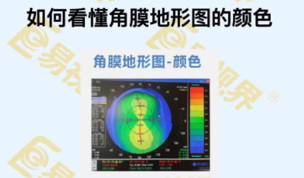如何看懂角膜地形图的颜色