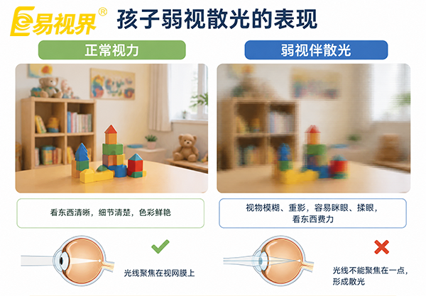 孩子弱视散光是什么原因造成的?易视界视光中心
